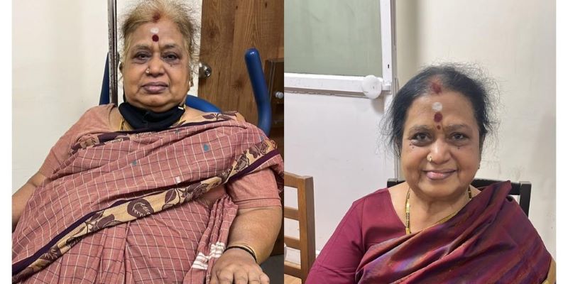 Happiness After Bariatric Surgery For Silver Citizen